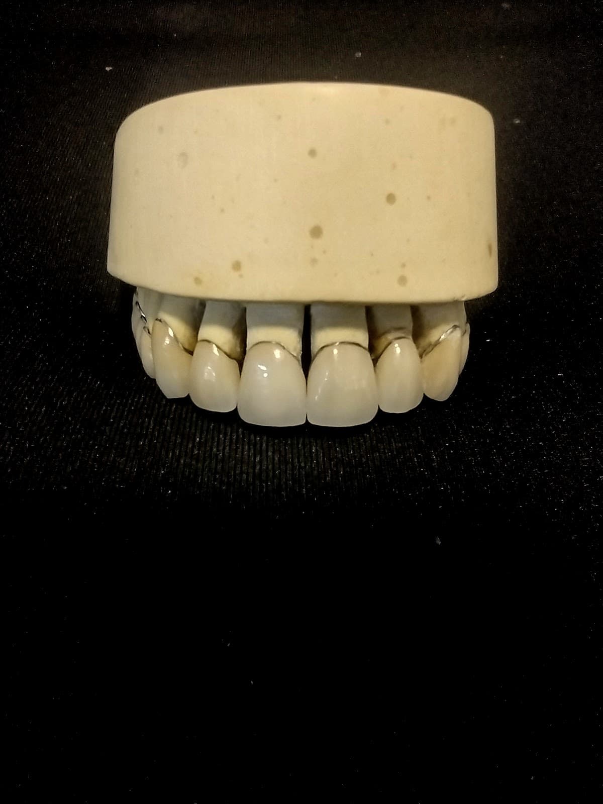 Coroas e pontes metalocerâmicas sobre bancada escura de laboratório dental