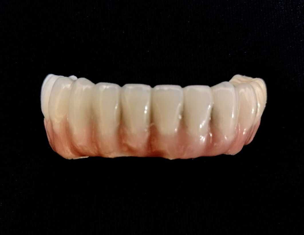 Estrutura de protocolo em metal sobre bancada de laboratório dental